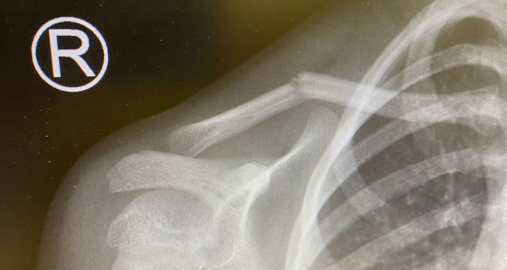 Opleiding Radiologische diagnostiek laagcomplexe onderzoeken Endoor ROC van Twente